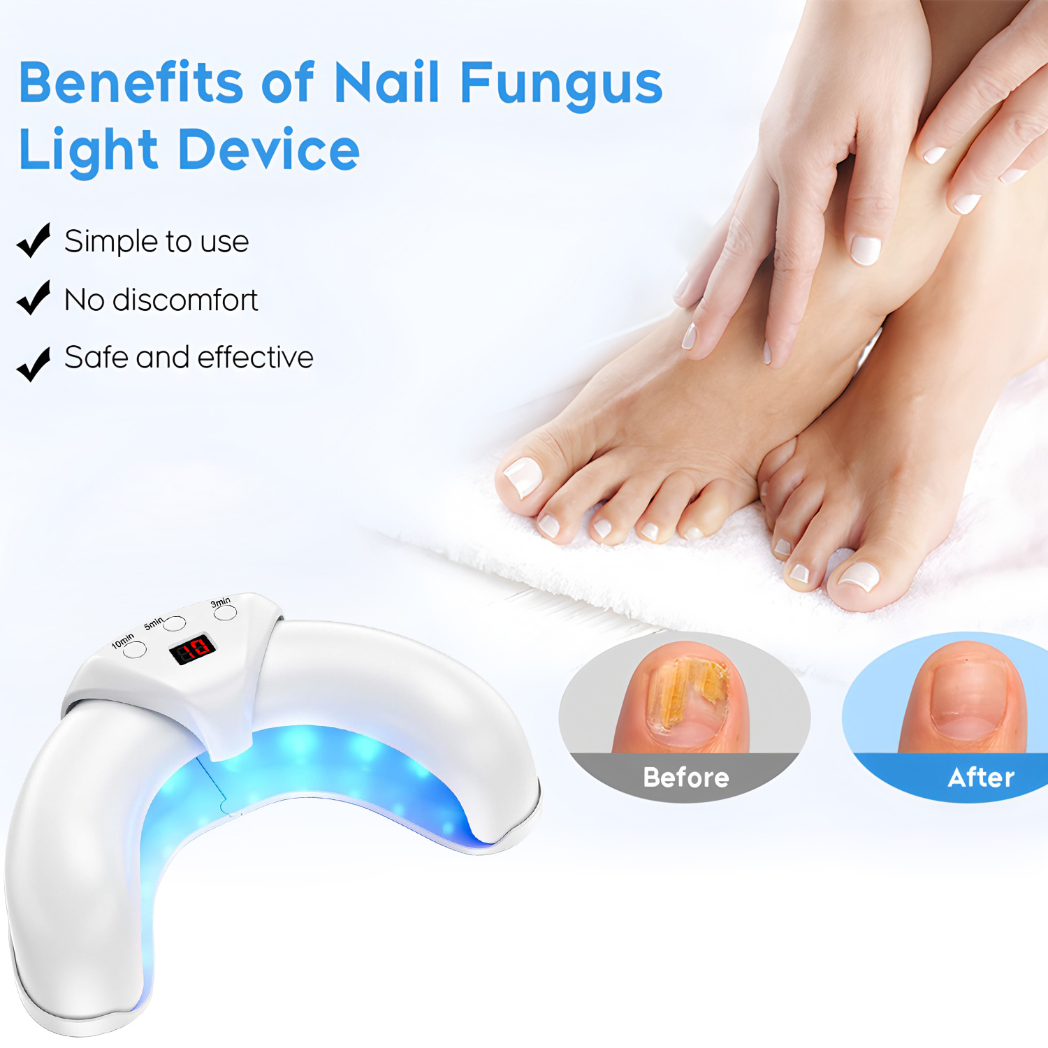 Fungus Laser Treatment Device  - Industrial Laser Removal 评论和价格